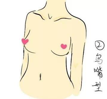 蜜桃胸型与水滴胸型的区别 胸型都有哪几种图解-第4张图片-爱薇女性网