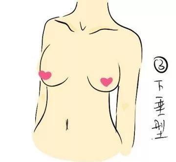 蜜桃胸型与水滴胸型的区别 胸型都有哪几种图解-第5张图片-爱薇女性网