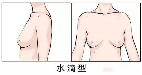 水滴形乳房图片：水滴胸形要如何选择文胸-第2张图片-爱薇女性网