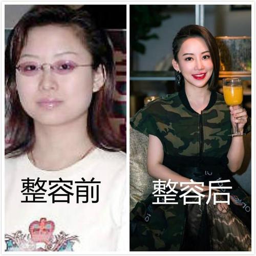 九球天后潘晓婷整容前后照片对比-第2张图片-爱薇女性网