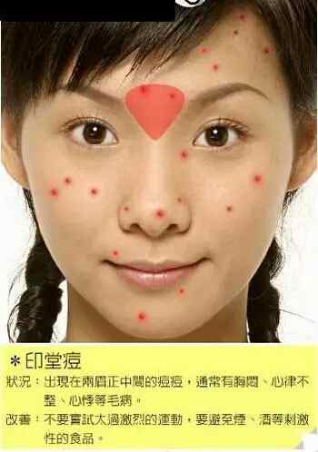 脸部各个部位长痘痘的原因示意图以及改善办法-第1张图片-爱薇女性网