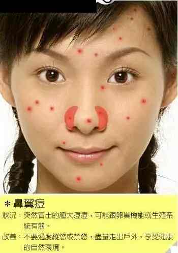 脸部各个部位长痘痘的原因示意图以及改善办法-第2张图片-爱薇女性网