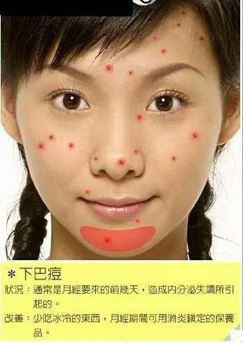脸部各个部位长痘痘的原因示意图以及改善办法-第3张图片-爱薇女性网