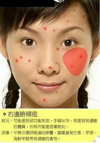 脸部各个部位长痘痘的原因示意图以及改善办法-第8张图片-爱薇女性网